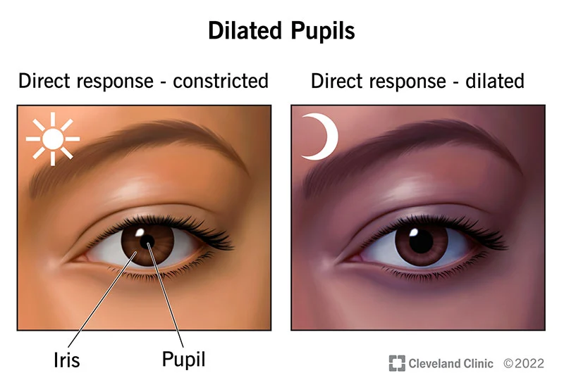 eye-dilation-know-its-importance-details-my-blog