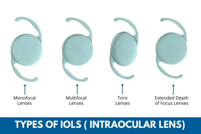 Monofocal, toric, EDOF and trifocal intraocular lens options for cataract surgery